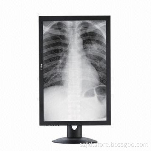 Medical LCD Monitor with VGA/DVI/HDMI®/DP Interface and 100 to 240V Voltage Input